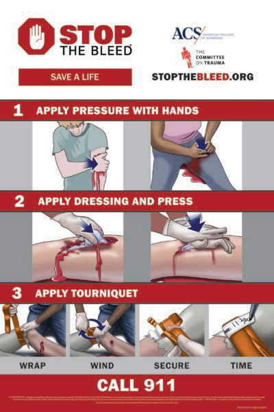 Stop the Bleed instructions